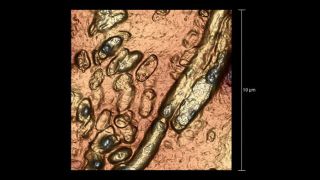 Xanthomonas campestris bacteria in potato agar