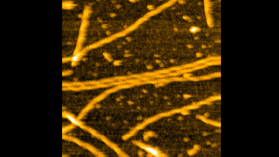 Actin filaments 400×400 nm2