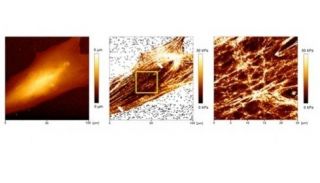 Topography image of living cell (left), stiffness image(center) and zoom up of square area